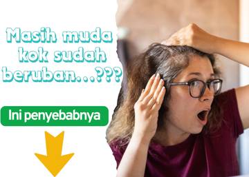 Penyebab Rambut  Beruban di Usia Muda